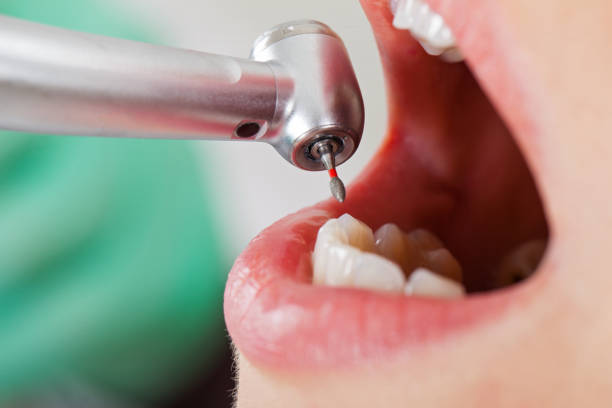 Best Emergency Treatment for Toothache in South Corning, NY